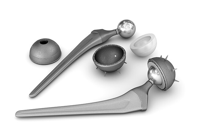 Joint implants - Artificial joints that replace a damaged body joint